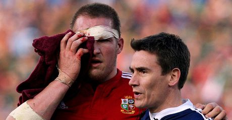 Jenkins: Cracked cheekbone