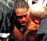 Audley Harrison: Had his nose smashed in his brutal defeat to David Price