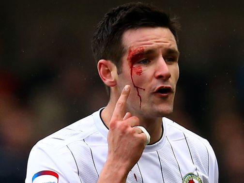 Scott Dann shows the scars of battle