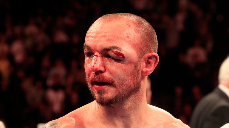 Kevin Mitchell: Third time unlucky at a world title