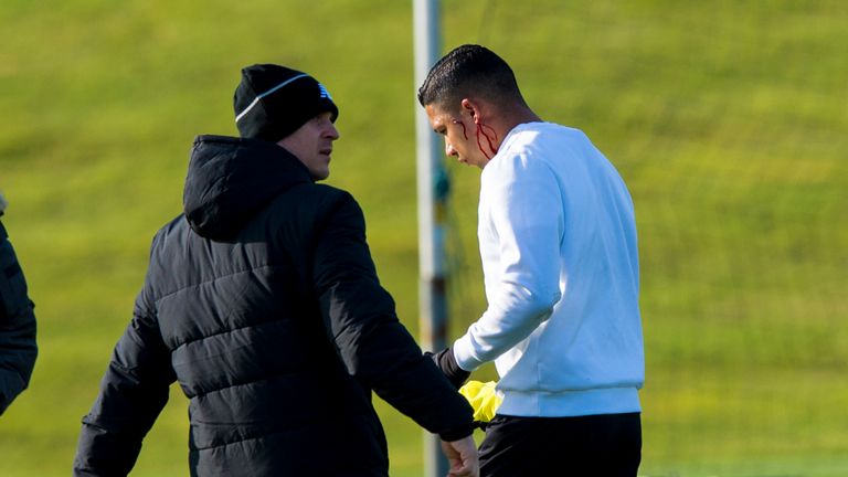 Celtic's Emilio Izaguirre (right) leaves the training field with physio Tim Williamson after clashing with Nadir Ciftci