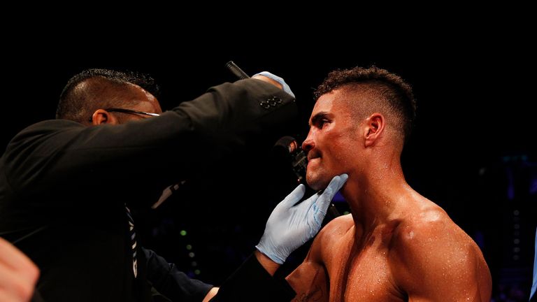 Anthony Ogogo had to undergo two eye operations after a defeat by Craig Cunningham