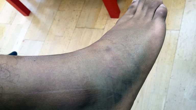 Gamal Yafai's injured ankle has ruled him out of Saturday's card
