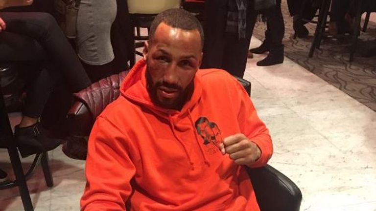 James DeGale shows off his wounds on Sunday morning (Twitter @jamesdegale1)