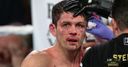 Smith suffers bad ear injury in defeat