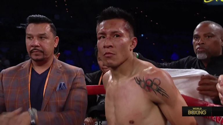 Boxer shares first picture of himself after horrifying ear injury Boxer shares first picture of himself after horrifying ear injury