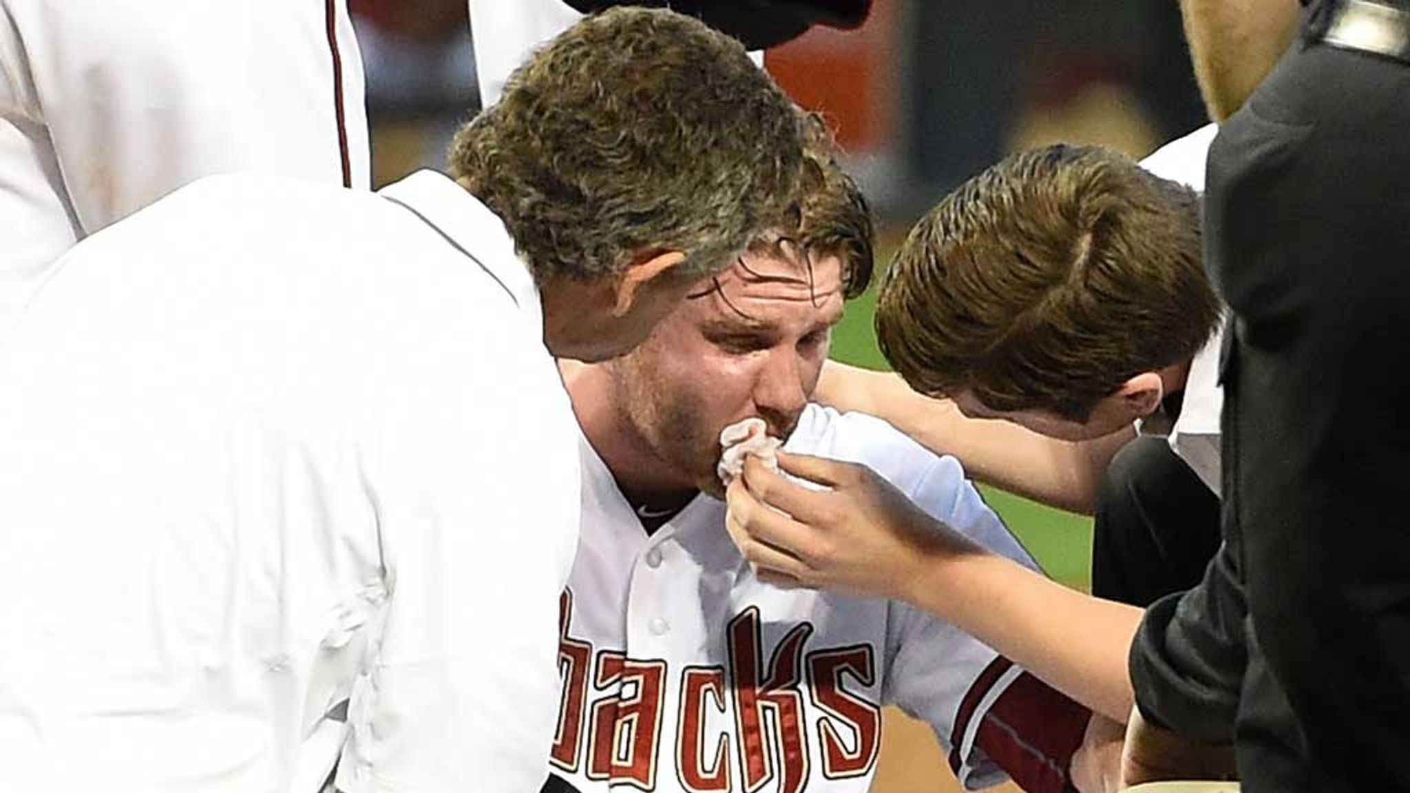 Ball travelling 115 mph strikes pitcher in face 