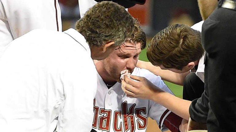 Archie Bradley treated by trainers after getting hit in face by baseball