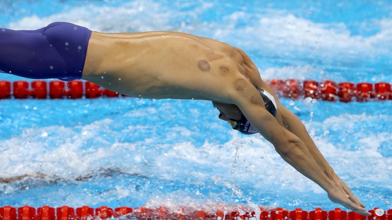 The strange red circles visible on Phelps are caused by the 'cupping' therapy