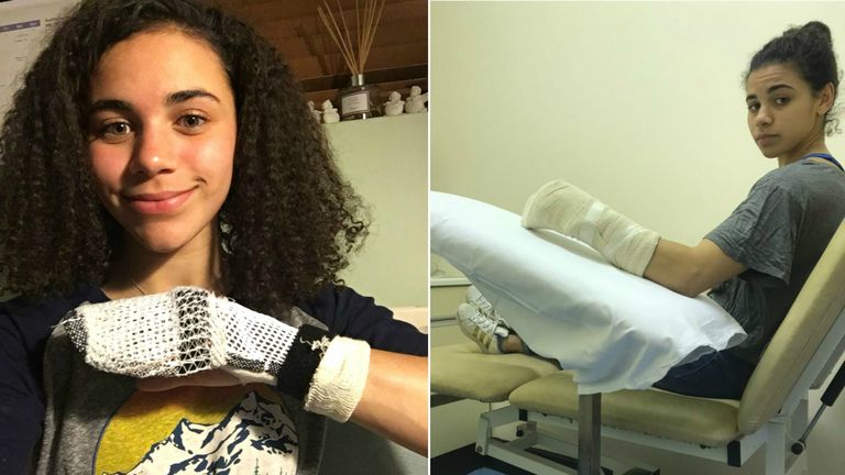 Molly Thompson-Smith faces a long spell away from the climbing walls