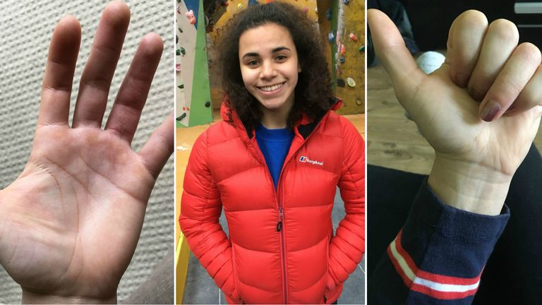 Molly Thompson-Smith is desperate to get back onto the wall again