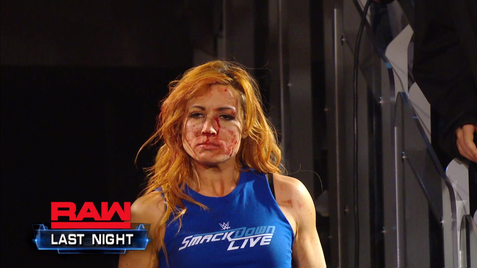 Who broke Becky Lynch's face as referenced by 29-year-old on RAW