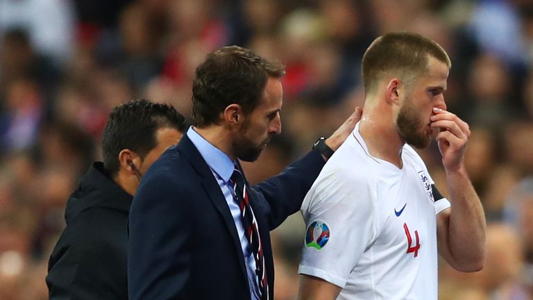 Eric Dier limped off at Wembley and will now miss their match against Montenegro on Monday