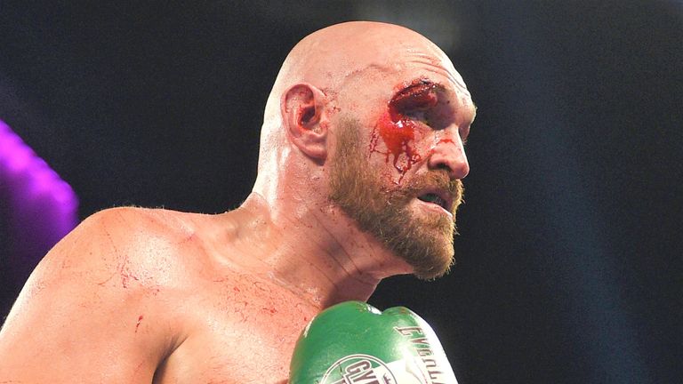 Tyson Fury sufrió recortes desagradables en la victoria por puntos sobre Otto Wallin