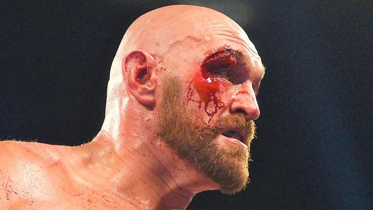 Tyson Fury sustained worrying cuts in a brutal win over Otto Wallin
