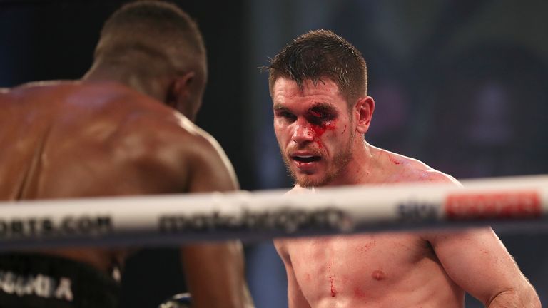 Ward suffered an awful cut in his draw with Essomba