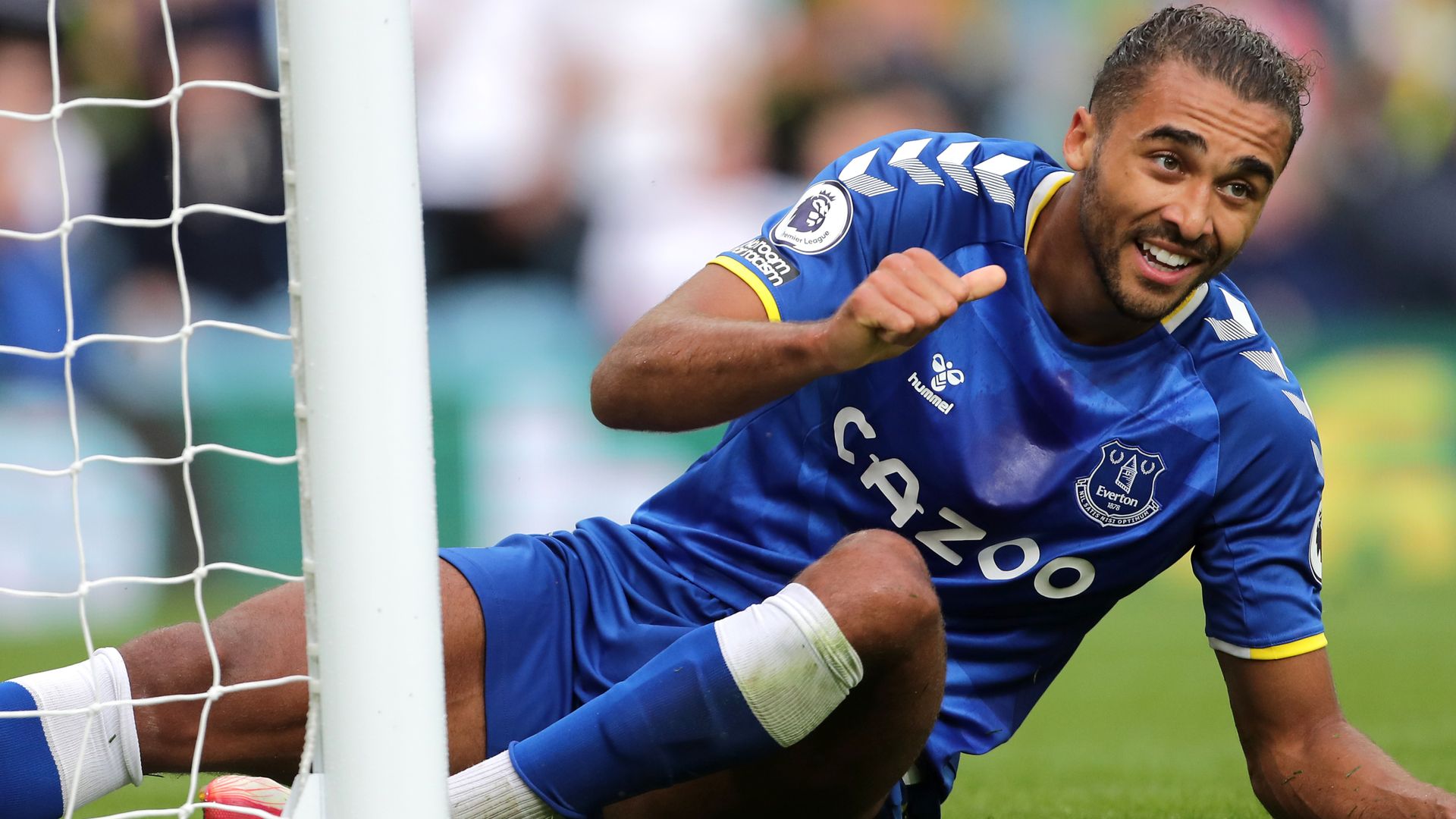 Benitez: Injured Calvert-Lewin facing few weeks out