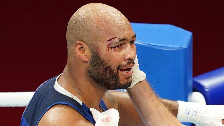 A cut ended Frazer Clarke's hopes of a gold or silver medal