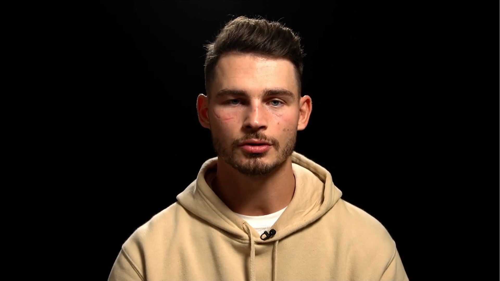 'I'm fighting a battle' - Stevie Ward on living with concussion