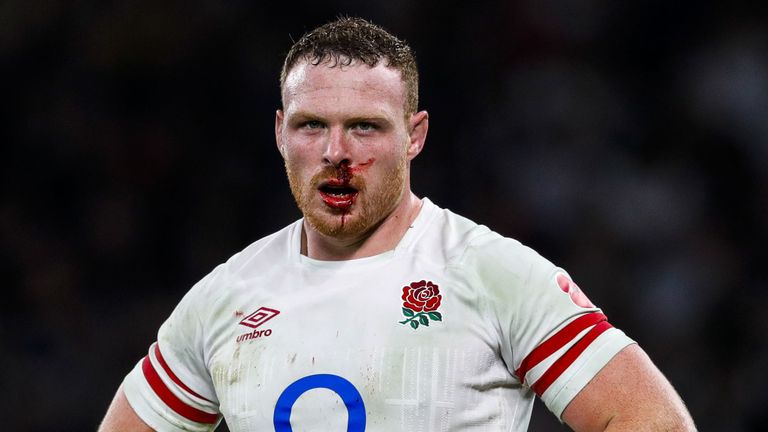 England's Sam Simmonds expects a power game when they come up against world champions South Africa at Twickenham on Saturday.
