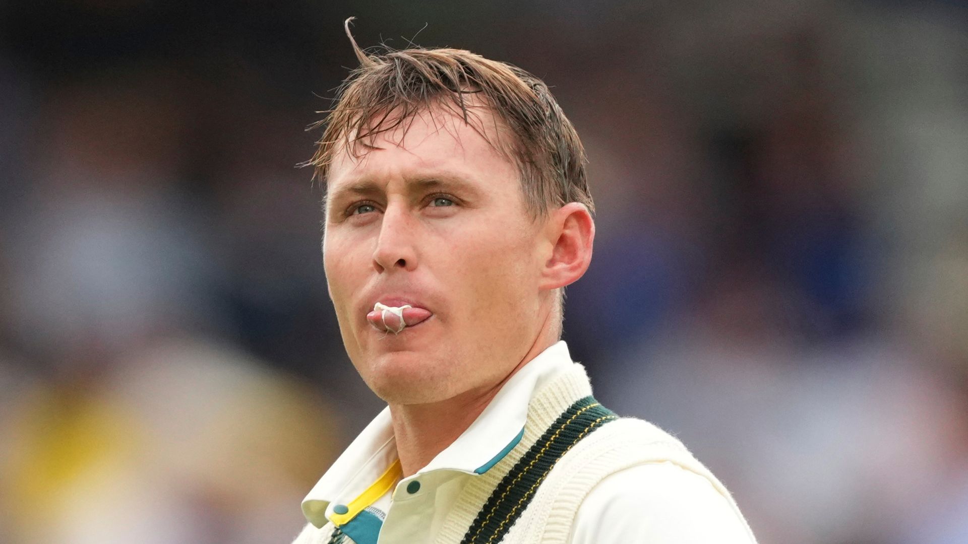 Australia axe Labuschagne, Smith injured for first West Indies Test