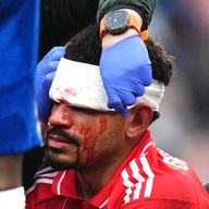 Nottingham Forest's Morgan Gibbs-White receives treatment for a head injury after a clash with Chelsea goalkeeper Robert Sanchez during the 